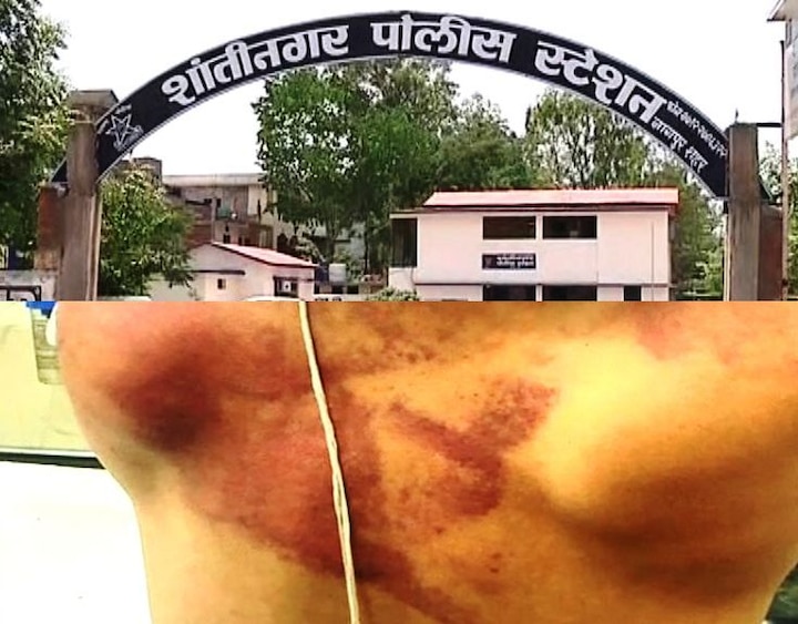 Nagpur police beaten brother and sister who were came to register complaint नागपुरात पोलिसांची भाऊ-बहिणीला अमानुष मारहाण