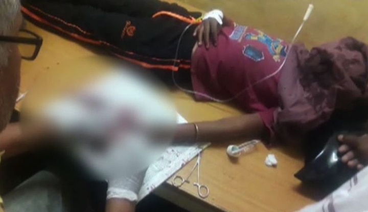Boy Severely Injured By Mobile Battery Explosion मोबाईलशी खेळताना बॅटरीचा स्फोट, मुलाची  बोटं तुटली