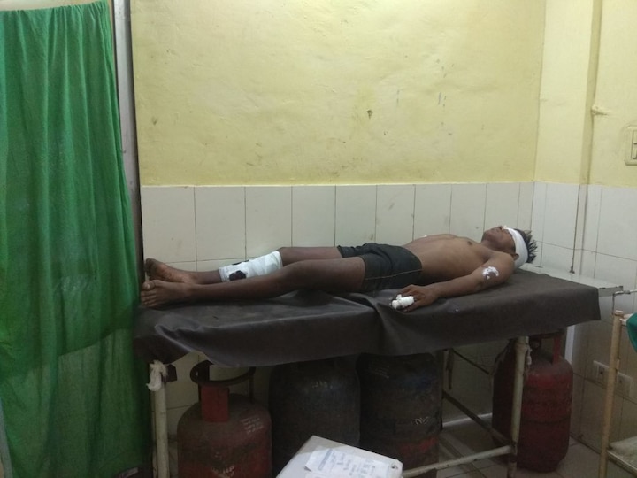 Pig attacked on man in khopoli खोपोलीत रानडुकराचा कामगारावर हल्ला