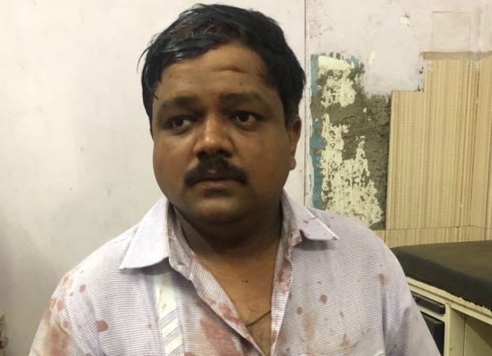 Ambarnath : Attack on Shivsena corporator's husband Chhotu Kale   अंबरनाथमध्ये शिवसेना नगरसेविकेच्या पतीवर हल्ला