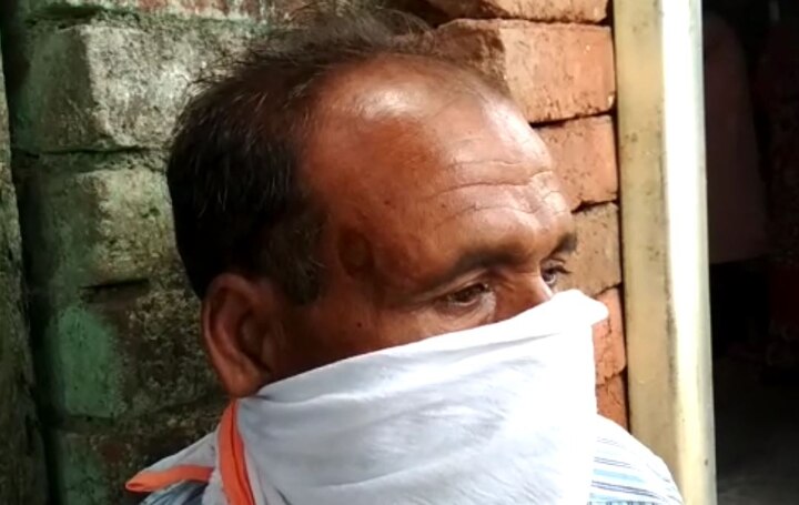son in law attack on father in law at Bhada village in Latur district सासऱ्याच्या नाकाला जावयाचा कडकडून चावा, नाकाचा शेंडा तुटला