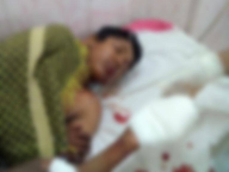 latur mobile battery blast मोबाईल बॅटरीच्या स्फोटात युवकाच्या हाताची बोटं तुटली