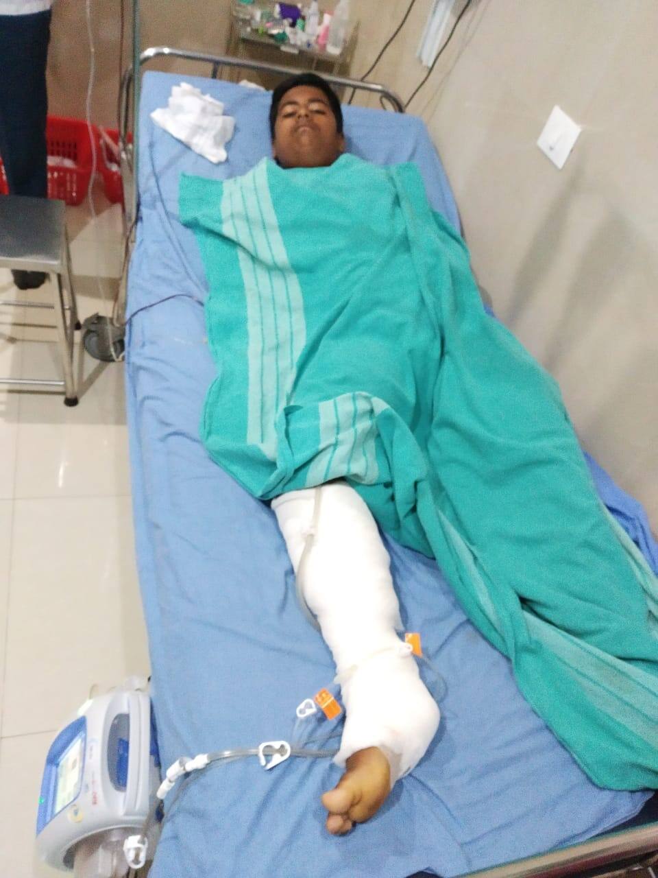 15 years old student loss his leg due to mistake of school bus driver स्कूल बस चालकाच्या चुकीमुळे विद्यार्थ्याचा उजवा पाय आयुष्यभरासाठी निकामी