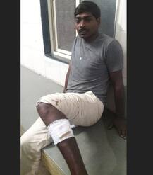 पुण्यात सलग दुसऱ्या दिवशी बिबट्याच्या हल्ल्यात चौघे जखमी