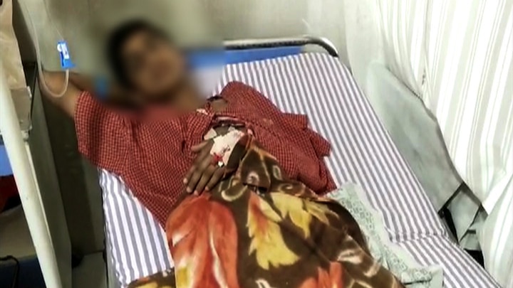 Tenth student knife attacked on classmate in Aurangabad औरंगाबादमध्ये दहावीच्या विद्यार्थ्यावर वर्गमित्राकडून कटरने वार
