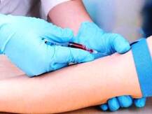 महापालिका रुग्णालयात गोरगरिबांना 139 रक्त चाचण्या मोफत