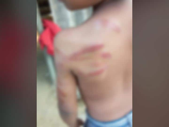 teacher brutally beat student in ambarnath अंबरनाथमध्ये शिक्षकाकडून तिसरीच्या विद्यार्थ्याला अमानुष मारहाण