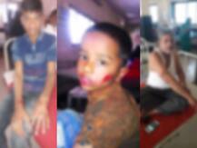 बीड शहरात पिसाळलेल्या कुत्र्याचा धुमाकूळ, हल्ल्यात 20 पेक्षा अधिक जखमी