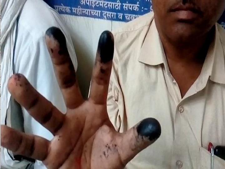 Loksabha Election 2019 - Indelible voters' ink causes burn over the fingers to the election worker at Parbhani मतदारांच्या बोटांना लावलेली शाई कर्मचाऱ्याला महागात, काळजी घेण्याचं डॉक्टरांचं आवाहन