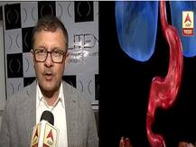 स्थूलपणा घटवण्याचा नवा पर्याय, बेरिअॅट्रिक एण्डोस्कोपी केंद्र सुरु