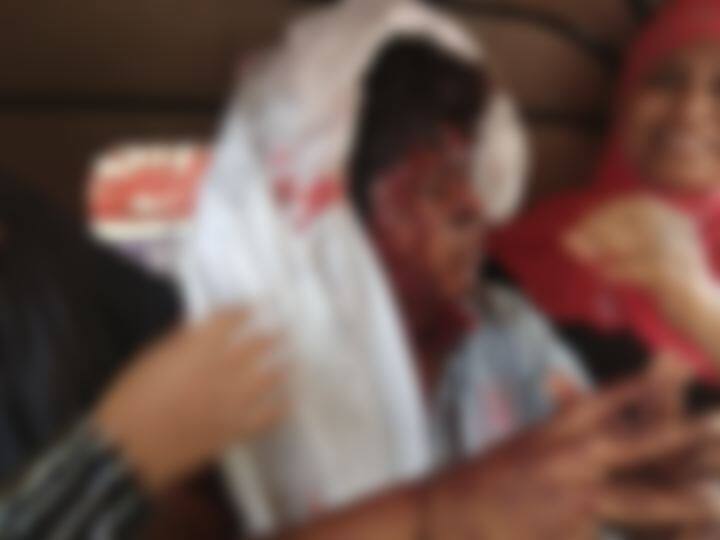 वर्गातील भांडणातून अकोल्यात एका विद्यार्थ्याचा दुसऱ्यावर विद्यार्थ्यावर चाकूहल्ला school student attacks his classmate due to small dispute in Akola वर्गातील भांडणातून अकोल्यात एका विद्यार्थ्याचा दुसऱ्यावर विद्यार्थ्यावर चाकूहल्ला