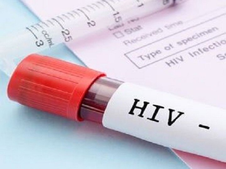 Goa government likely to make HIV test mandatory before marriage गोव्यात लग्नापूर्वी एचआयव्ही चाचणी करणं बंधनकारक होणार!