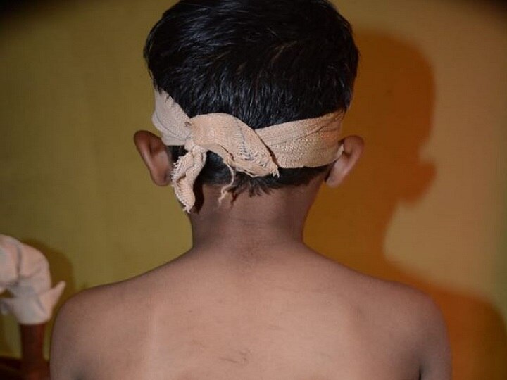 Aurangabad - Student beaten up by institute director for eating biscuits without permission न विचारता बिस्किटं खाल्ली म्हणून विद्यार्थ्याला डोकं फुटेपर्यंत मारहाण