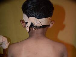 न विचारता बिस्किटं खाल्ली म्हणून विद्यार्थ्याला डोकं फुटेपर्यंत मारहाण