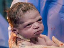 डॉक्टरांना पाहून नवजात बाळ का रागावलं? क्यूट फोटोमागची कहाणी!