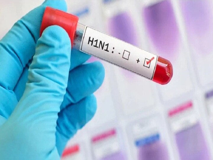 Health Tips H1n1 entered in india many people infected HEALTH : भारतात स्वाइन फ्लूचा हैदोस; जाणून घ्या लक्षणं आणि उपाय