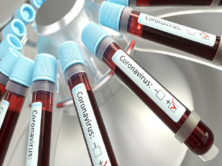 Coronavirus - IIT-Delhi researchers develops cheap COVID-19 test Coronavirus | IIT दिल्लीकडून नवी पद्धत विकसित, कोविड-19ची स्वस्त चाचणी शक्य?