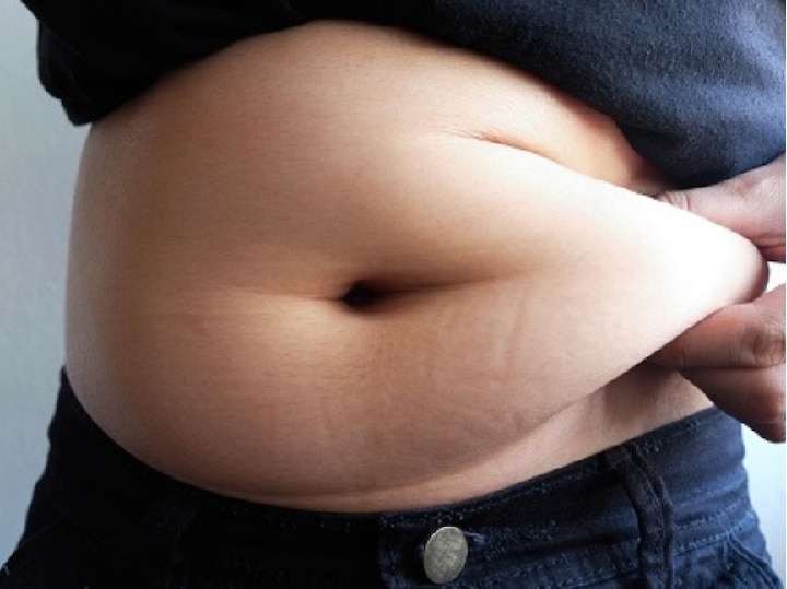 194 kg person Obesity operation successful in solapur govt hospital 194 किलोच्या व्यक्तीवर लठ्ठपणाची यशस्वी शस्त्रक्रिया, सोलापूर शासकीय रुग्णालयात उपचार