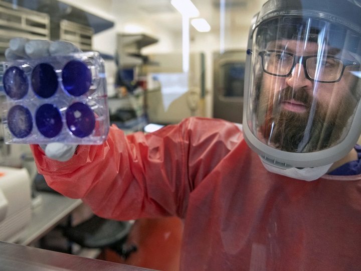 Coronavirus | एकदा संसर्ग झाल्यानंतर पुन्हा कोरोनाचा संसर्ग होऊ शकतो का? Coronavirus Update can covid 19 or Corona affect after recovery