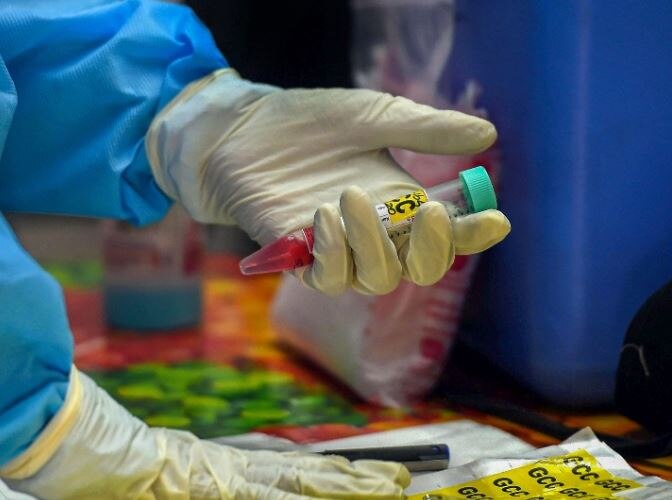 Coronavirus vaccine shows promise in early trials, claims American company Moderna Coronavirus | कोरोना लसची प्राथमिक मानवी चाचणी यशस्वी, अमेरिकेतील मॉडर्ना कंपनीचा दावा