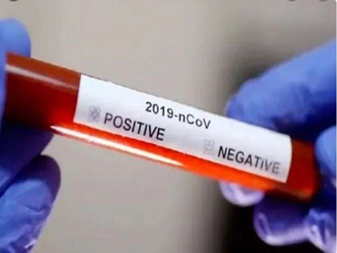 corona update, 252 people corona positive in antigen test in aurangabad  औरंगाबादेत कोरोना अँटिजन टेस्टमध्ये पहिल्याच दिवशी 87 विक्रेत्यासह 252 पॉझिटिव्ह