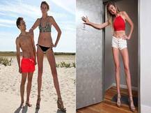 6 ਫੁੱਟ 5 ਇੰਚ ਦੀ ਕੁੜੀ, ਲੰਬੀਆਂ ਲੱਤਾਂ ਅੱਗੇ ਬੌਣਾ ਲੱਗਦਾ ਸਭ ਕੁਝ