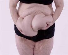 ਉਮਰ 34 ਸਾਲ ਤੇ ਭਾਰ 195 ਕਿਲੋ ਕਿਉਂ !