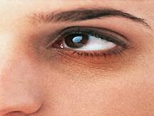 ਤੁਹਾਡੇ ਫ੍ਰਿਜ਼ \'ਚ ਲੁਕਿਆ ਹੈ Dark Circles ਦਾ ਉਪਾਅ