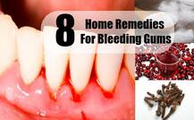 ਮਸੂੜ੍ਹਿਆਂ ਤੋਂ ਖ਼ੂਨ ਆਉਣ ਦਾ ਦੇਸੀ ਇਲਾਜ਼