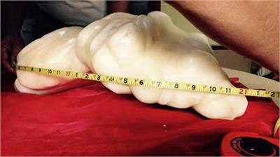 ਮਛੇਰਾ ਖੋਲ ਸਣੇ ਮੋਤੀ ਨੂੰ ਘਰ ਲੈ ਆਇਆ।ਉਸ ਨੇ ਇਸ ਨੂੰ ਭਾਗਸ਼ਾਲੀ ਪੱਥਰ ਸਮਝ ਕੇ ਆਪਣੇ ਬੈੱਡ ਹੇਠਾਂ ਰੱਖ ਦਿੱਤਾ। ਦੱਸਣਯੋਗ ਹੈ ਕਿ ਆਮ ਤੌਰ 'ਤੇ ਕਿਸੇ ਵੀ ਮੋਤੀ ਦਾ ਅਕਾਰ 1 ਸੈਮੀ ਤੋਂ 3 ਸੈਮੀ ਤੱਕ ਦਾ ਹੁੰਦਾ ਹੈ, ਪਰ ਇਹ ਮੋਤੀ 26 ਇੰਜ ਲੰਬਾ ਤੇ 12 ਇੰਚ ਚੌੜਾ ਹੈ।ਪਹਿਲਾਂ ਇਹ ਰਿਕਾਰਡ ਪਰਲ ਆਫ ਅੱਲ੍ਹਾ ਦੇ ਨਾਂਅ ਸੀ, ਜਿਸ ਦੀ ਕੀਮਤ 4 ਕਰੋੜ ਡਾਲਰ (260 ਕਰੋੜ ਰੁਪਏ) ਹੈ। 