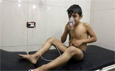 ਦੱਸਣਯੋਗ ਹੈ ਕਿ ਸੀਰੀਅਨ ਸਿਵਲ ਡਿਫੈਂਸ ਨੇ ਸਰਕਾਰ 'ਤੇ ਅਗਸਤ 'ਚ ਵੀ ਕਲੋਰੀਨ ਹਮਲੇ ਕਰਨ ਦੇ ਦੋਸ਼ ਲਾਏ ਸਨ। ਰਿਪੋਰਟ ਮੁਤਾਬਿਕ ਸੀਰੀਆ 'ਚ ਇਸ ਸਮੇਂ ਛੇ ਲੱਖ ਤੋਂ ਜ਼ਿਆਦਾ ਲੋਕ ਘੇਰੇ ਬੰਦੀ 'ਚ ਰਹਿ ਰਹੇ ਹਨ। ਇੱਥੇ ਐਤਵਾਰ ਨੂੰ ਸੀਰੀਆ ਦੇ ਸਰਕਾਰੀ ਫ਼ੌਜ ਬਲ ਨੇ ਅਲੈਪੋ ਦੇ ਕੁੱਝ ਇਲਾਕਿਆਂ 'ਤੇ ਫਿਰ ਤੋਂ ਕਬਜ਼ਾ ਕਰ ਲਿਆ ਹੈ, ਜਿਸ ਨਾਲ ਸ਼ਹਿਰ ਦੇ ਵਿਦਰੋਹੀਆਂ ਦੇ ਕਬਜ਼ੇ ਵਾਲੇ ਪੂਰਬੀ ਜ਼ਿਲ੍ਹੇ ਫਿਰ ਤੋਂ ਘੇਰੇ ਬੰਦੀ 'ਚ ਆ ਗਏ ਹਨ।