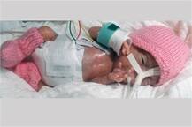 ਦੁਨੀਆ ਦੀ ਸਭ ਤੋਂ ਛੋਟੀ ਬੱਚੀ ਦੀ ਲੰਬਾਈ ਸੁਣ ਕੇ ਰਹਿ ਜਾਵੋਗੇ ਹੈਰਾਨ 