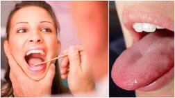 ਮਰੀਜ਼ ਦੀ ਜੀਭ ਕਿਉਂ ਦੇਖੀ ਜਾਂਦੀ ਹੈ?