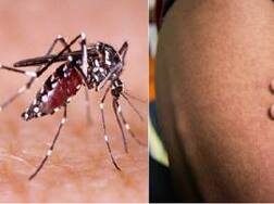 ਕੀ ਹੈ ਚਿਕਨਗੁਨੀਆ ਬੁਖਾਰ, ਜਾਣੋ ਕਿਵੇਂ ਕਰੀਏ ਬਚਾਅ ?