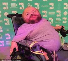 ਹੱਡੀਆਂ ਤੋਂ ਬਿਨਾਂ ਨੇ ਹੱਥ ਪੈਰ, ਪਰ ਇਸਦੀ ਜ਼ਿੰਦ-ਦਿਲੀ ਦਾ ਹਰ ਕੋਈ ਕਾਇਲ