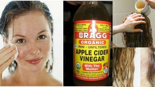 Ways To Use Vinegar For More Beautiful Skin And Hair ਇਸ ਸਿਰਕੇ ਨਾਲ ਸਿਹਤ ਦੀਆਂ ਇਹ ਸੱਮਸਿਆਵਾਂ ਹੁੰਦੀਆਂ ਦੂਰ