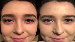 ਖੁਸ਼ਖਬਰੀ : ਉਮਰ ਦੇ ਅਸਰ ਨੂੰ ਘੱਟ ਕਰਨਾ ਹੋਵੇਗਾ ਸੰਭਵ