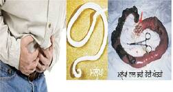 ਕਿਉਂ ਪੈਂਦੇ ਨੇ ਪੇਟ 'ਚ ਕੀੜੇ ? ਜਾਣੋ ਇਸਦੇ ਕਾਰਨ ਤੇ ਇਲਾਜ ਬਾਰੇ