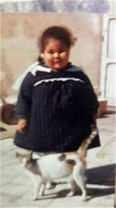 ਮੋਟਾਪੇ ਕਾਰਨ ਨਾ ਇਹ ਹਿੱਲ ਸਕਦੀ ਹੈ ਅਤੇ ਨਾ ਹੀ ਆਪਣਾ ਕੋਈ ਕੰਮ ਕਰ ਸਕਦੀ ਹੈ। ਡਾਕਟਰਾਂ ਦਾ ਕਹਿਣਾ ਹੈ ਕਿ ਗ੍ਰੰਥੀਆਂ ਦੇ ਨਸ਼ਟ ਹੋਣ ਕਾਰਨ ਉਸ ਦੇ ਸਰੀਰ 'ਚ ਜ਼ਿਆਦਾ ਪਾਣੀ ਜਮ੍ਹਾ ਹੋ ਜਾਂਦਾ ਹੈ। 