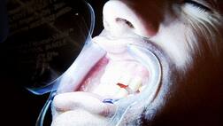 ਮੂੰਹ ਤੇ ਦੰਦਾਂ ਦੀ ਸਫਾਈ ਨਾ ਕਰਨਾਂ ਹੋ ਸਕਦਾ ਬੇਹੱਦ ਖ਼ਤਰਨਾਕ..