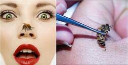 ਤੇਜ਼ਾਬ, ਖਾਰ, ਸ਼ਹਿਦ ਦੀ ਮੱਖੀ ਅਤੇ ਭਰਿੰਡ ਦੇ ਡੰਗ ਤੋਂ ਬਚਾਅ ਦੇ ਨੁਕਤੇ