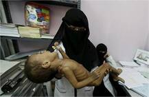 ਪਿੰਜਰ ਬਣਦੇ ਜਾ ਰਹੇ ਨੇ ਇੱਥੋਂ ਦੇ ਲੋਕ..ਡਾਕਟਰਾਂ ਦੇ ਬੱਸੋ ਬਾਹਰ