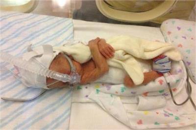 ਮਾਂ ਦਾ ਕਹਿਣਾ ਹੈ ਕਿ ਜਨਮ ਤੋਂ ਲੈ ਕੇ ਹੁਣ ਉਸ ਨੂੰ ਕਾਫੀ ਪ੍ਰੇਸ਼ਾਨੀਆਂ ਦਾ ਸਾਹਣਾ ਕਰਨਾ ਪਿਆ। ਉਸ ਦੇ ਜਨਮ ਦੇ ਅਗਲੇ ਮਹੀਨੇ ਤੋਂ ਉਸ ਦੇ 6 ਆਪ੍ਰੇਸ਼ਨ ਕੀਤੇ ਗਏ। ਹੁਣ ਉਹ 2 ਸਾਲ ਦਾ ਹੋ ਗਿਆ ਹੈ ਅਤੇ ਉਸ ਦਾ ਭਾਰ 9 ਕਿਲੋ ਹੋ ਚੁੱਕਾ ਹੈ। ਸਾਡਾ ਬੇਟਾ ਜਿੰਨਾ ਵੀ ਸਮਾਂ ਸਾਡੇ ਨਾਲ ਹੈ ਉਹ ਬਹੁਤ ਖੂਬਸੂਰਤ ਹੈ।