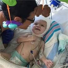 ਜੁੜੇ ਸਿਰ ਹੋਏ ਵੱਖ, ਪਹਿਲੀ ਬਾਰ ਦੇਖਿਆ ਇੱਕ-ਦੂਜੇ ਨੂੰ..ਜਾਣੋ ਮਾਮਲਾ