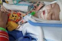 ਜੁੜੇ ਸਿਰ ਹੋਏ ਵੱਖ, ਪਹਿਲੀ ਬਾਰ ਦੇਖਿਆ ਇੱਕ-ਦੂਜੇ ਨੂੰ..ਜਾਣੋ ਮਾਮਲਾ