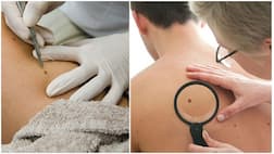 ਸਾਵਧਾਨ! ਇਹ ਤਿਲ ਕਿਤੇ ਕੈਂਸਰ ਤਾਂ ਨਹੀਂ 