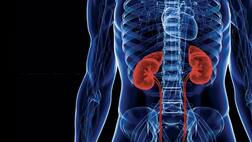 ਕਿਡਨੀ ਫੇਲ੍ਹ ਹੋਣ ਵਾਲੇ ਮਰੀਜ਼ਾਂ ਲਈ ਨਵਾਂ ਖ਼ਤਰਾ