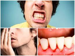 ਇਸ ਨੂੰ ਧਿਆਨ 'ਚ ਰੱਖਦੇ ਹੋਏ ਦੰਦ 'ਚ ਸਟੈਮ ਸੈੱਲਾਂ ਨੂੰ ਪ੍ਰੇਰਿਤ ਕਰਨ ਦਾ ਤਰੀਕਾ ਲੱਭਿਆ ਗਿਆ ਹੈ। ਇਸ ਬਾਇਓਲੌਜੀਕਲ ਤਰੀਕੇ 'ਚ ਦੰਦ ਆਪਣੀ ਸੁਭਾਵਿਕ ਸਮਰੱਥਾ ਨਾਲ ਕੈਵਿਟੀ ਨੂੰ ਖੁਦ ਹੀ ਠੀਕ ਕਰ ਸਕਦੇ ਹਨ। ਇਸ 'ਚ ਸੀਮੈਂਟ ਜਾਂ ਫਿਲਿੰਗ ਦੀ ਲੋੜ ਨਹੀਂ ਪਵੇਗੀ। ਇਸ ਨਾਲ ਇਨਫੈਕਸ਼ਨ ਦਾ ਖ਼ਤਰਾ ਰਹਿੰਦਾ ਹੈ।