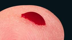 ਖ਼ੂਨ ਦੀ ਜਾਂਚ ਦੱਸੇਗੀ ਕਿਸ ਹਿੱਸੇ 'ਚ ਹੈ ਕੈਂਸਰ