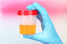 ਅਮਰੀਕੀ ਕੁੜੀ ਦਾ ਵਿਕਦਾ ਪਿਸ਼ਾਬ, ਕਮਾਈ ਦਾ ਬਣਾਇਆ ਸਾਧਨ